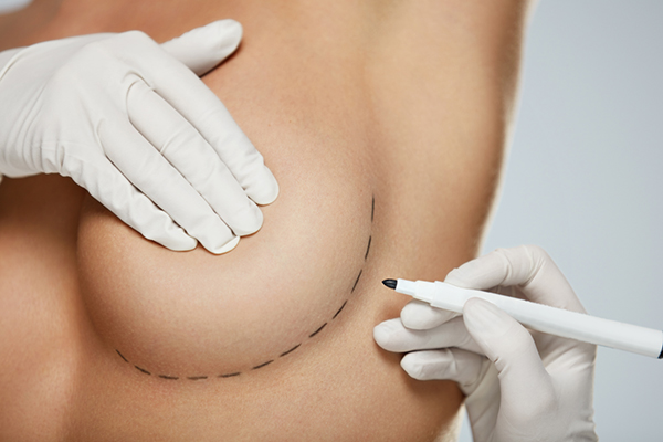 Breast Surgery